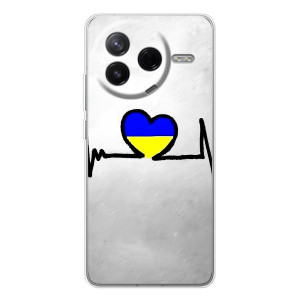 Силіконовий Чохол  на Xiaomi Civi 4Pro (Я-Україна) – Українська кардіограма