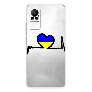 Силиконовый Чехол на Xiaomi Civi (Я-Украина) – Украинская кардиограмма