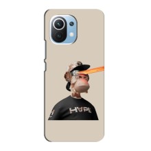 Чехлы с Обезьянами NFT для Xiaomi Mi 11 Lite (AlphaPrint) (обезьяна NFT в очках)