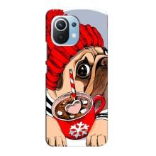 Чехлы с собаками для Xiaomi Mi 11 Lite (VPrint) (Собачка в шапке)