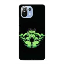 Чохли з героями Марвел Xiaomi Mi 11 Lite (VPrint)