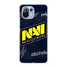 Чохол КІБЕРСПОРТ для Xiaomi Mi 11 Lite (NAVI)
