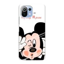Чехлы для телефонов Xiaomi Mi 11 Lite - Дисней – Mickey Mouse