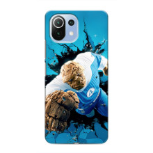 Чехол с принтом Фантастическая четверка для Xiaomi Mi 11 Lite – Существо