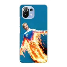 Чехол с принтом Фантастическая четверка для Xiaomi Mi 11 Lite – Человек-Факел