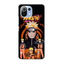 Naruto Anime Чохли для Сяомі Мі 11 Лайт (AlphaPrint)