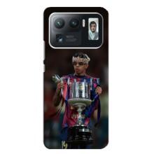 Чехол с футболистом Ламин Ямаль Xiaomi Mi 11 Ultra (Ямал с кубком)