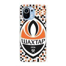 Чехлы для Xiaomi Mi 11 (VPrint) - Футбольные клубы