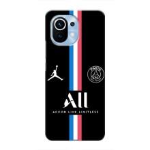Чехлы PSG для Xiaomi Mi 11 (AlphaPrint)