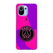 Чехлы PSG для Xiaomi Mi 11 (AlphaPrint)