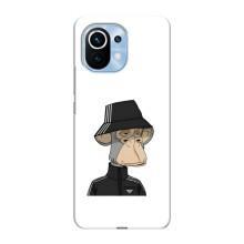 Чехлы с Обезьянами NFT для Xiaomi Mi 11 (AlphaPrint)
