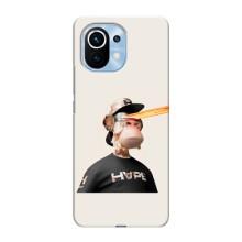 Чехлы с Обезьянами NFT для Xiaomi Mi 11 (AlphaPrint)