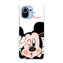 Чехлы для телефонов Xiaomi Mi 11 - Дисней – Mickey Mouse