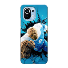 Чохол з принтом Фантастична четвірка для Xiaomi Mi 11 – Істота