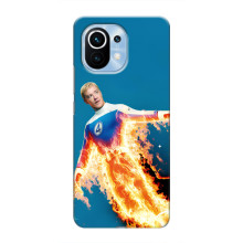 Чохол з принтом Фантастична четвірка для Xiaomi Mi 11 – Людина-факел