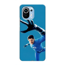 Чохол з принтом Фантастична четвірка для Xiaomi Mi 11 – Містер Фантастік