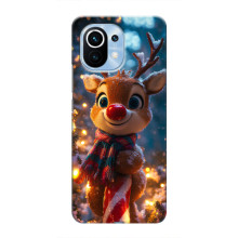 Яскравий чохол для Xiaomi Mi 11 з Зимові Оленята – Олень з шарфом