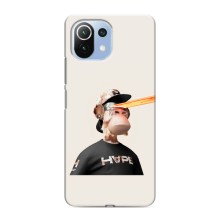 Чехлы с Обезьянами NFT для Xiaomi Mi 11i (AlphaPrint) (обезьяна NFT в очках)
