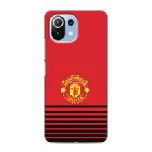 Чехол Манчестер Юнайтед для Сяоми Ми 11i (AlphaPrint) (manchester united)