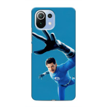 Чехол с принтом Фантастическая четверка для Xiaomi Mi 11i – Мистер Фантастик