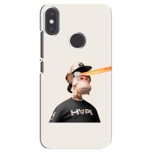 Чехлы с Обезьянами NFT для Xiaomi Mi A2 (AlphaPrint) (обезьяна NFT в очках)