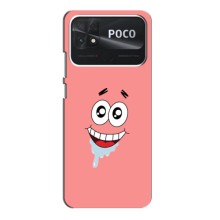 Чехлы с Патриком на Xiaomi Poco C40 (Мордочка Патрика)