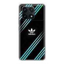 Чохли Адидас для Xiaomi POCO F6 Pro (AlphaPrint) (Адідас з полосами)