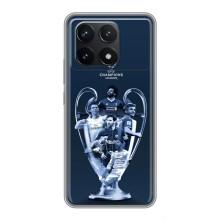 Чехлы для Xiaomi POCO F6 Pro (VPrint) - Футбольные клубы