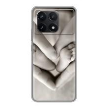 Чехлы для МАМЫ на Xiaomi POCO F6 Pro – Любящие руки