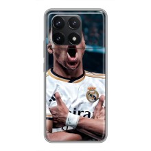 Чехол (TPU) с Футболистом на Xiaomi POCO F6 Pro (Гол Мбаппе)