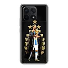 Чехлы Лео Месси Аргентина для Xiaomi POCO F6 Pro – Месси король
