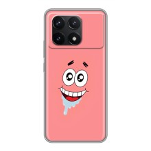 Чехлы с Патриком на Xiaomi POCO F6 Pro (Мордочка Патрика)