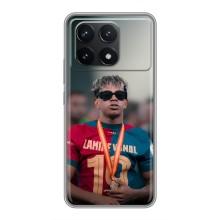 Чехол с футболистом Ламин Ямаль Xiaomi POCO F6 Pro – Ямаль Барса