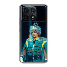 Чохол з картинкою Олександр Усик для Xiaomi POCO F6 Pro – Усик Гетьман