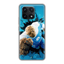 Чехол с принтом Фантастическая четверка для Xiaomi POCO F6 Pro – Существо