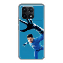 Чехол с принтом Фантастическая четверка для Xiaomi POCO F6 Pro – Мистер Фантастик