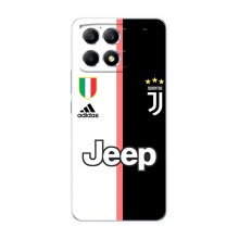 Чохли для Xiaomi POCO F6 (VPrint) - Футбольні клуби (Juventus)