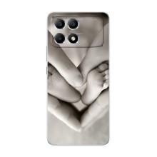 Чехлы для МАМЫ на Xiaomi POCO F6 – Любящие руки