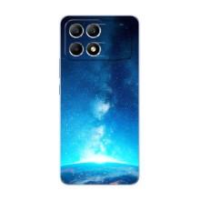 Чехлы КОСМОС для Xiaomi POCO F6 – Млечный путь