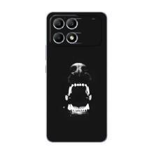Чехол ДОБЕРМАН для Xiaomi POCO F6 – Пасть добермана