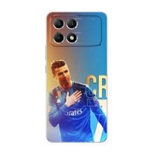 Чохол Кріштіану Роналду для Xiaomi POCO F6 (AlphaPrint) (CR7 Real)