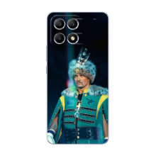 Чохол з картинкою Олександр Усик для Xiaomi POCO F6 – Усик Гетьман