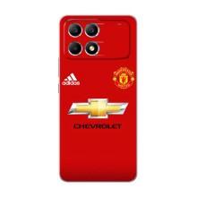 Силиконовые Чехлы принт Футбол на Xiaomi POCO F6 – Man United
