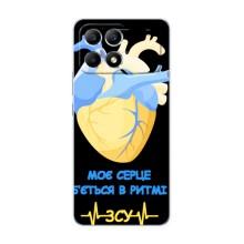 ЗСУ Чохли (TPU) для Xiaomi POCO F6 – Ритм ЗСУ