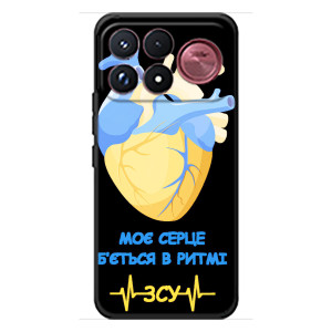 ЗСУ Чехлы (TPU) для Xiaomi Poco F9 Ultra (Ритм ЗСУ)