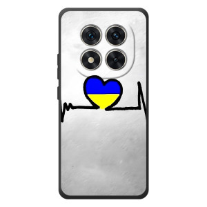 Силиконовый Чехол на Xiaomi Poco M8 Pro (Я-Украина) – Украинская кардиограмма