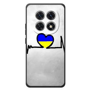 Силиконовый Чехол на Xiaomi Poco M8 (Я-Украина) – Украинская кардиограмма