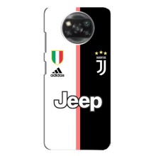 Чехлы для Xiaomi POCO X3 Pro (VPrint) - Футбольные клубы (Juventus)