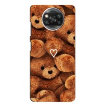 Чехлы Мишка Тедди для Xiaomi Poco X3 Pro – Плюшевый медвеженок