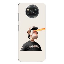 Чехлы с Обезьянами NFT для Xiaomi POCO X3 Pro (AlphaPrint) (обезьяна NFT в очках)